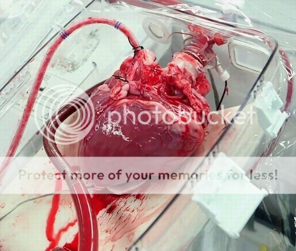 heart6_zpsaa4eipgf.jpg